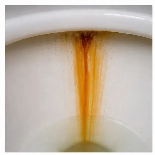 thumbnail — orange rust streak running vertically from the rim down the inside of a toilet bowl.